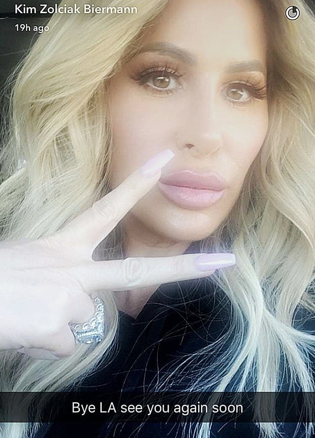 Kim Zolciak Is Bruised And Swollen After Getting Her Lips Redone