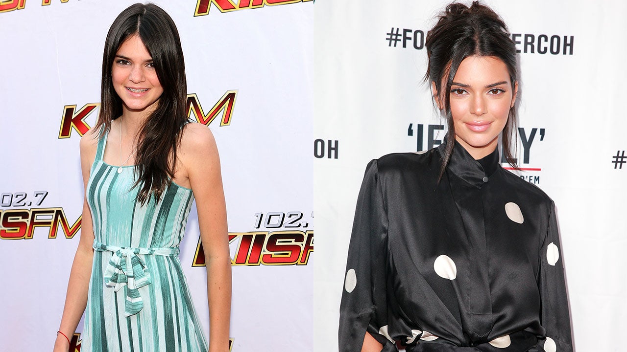 Proof That There's No Trend Too Ugly for Kendall Jenner