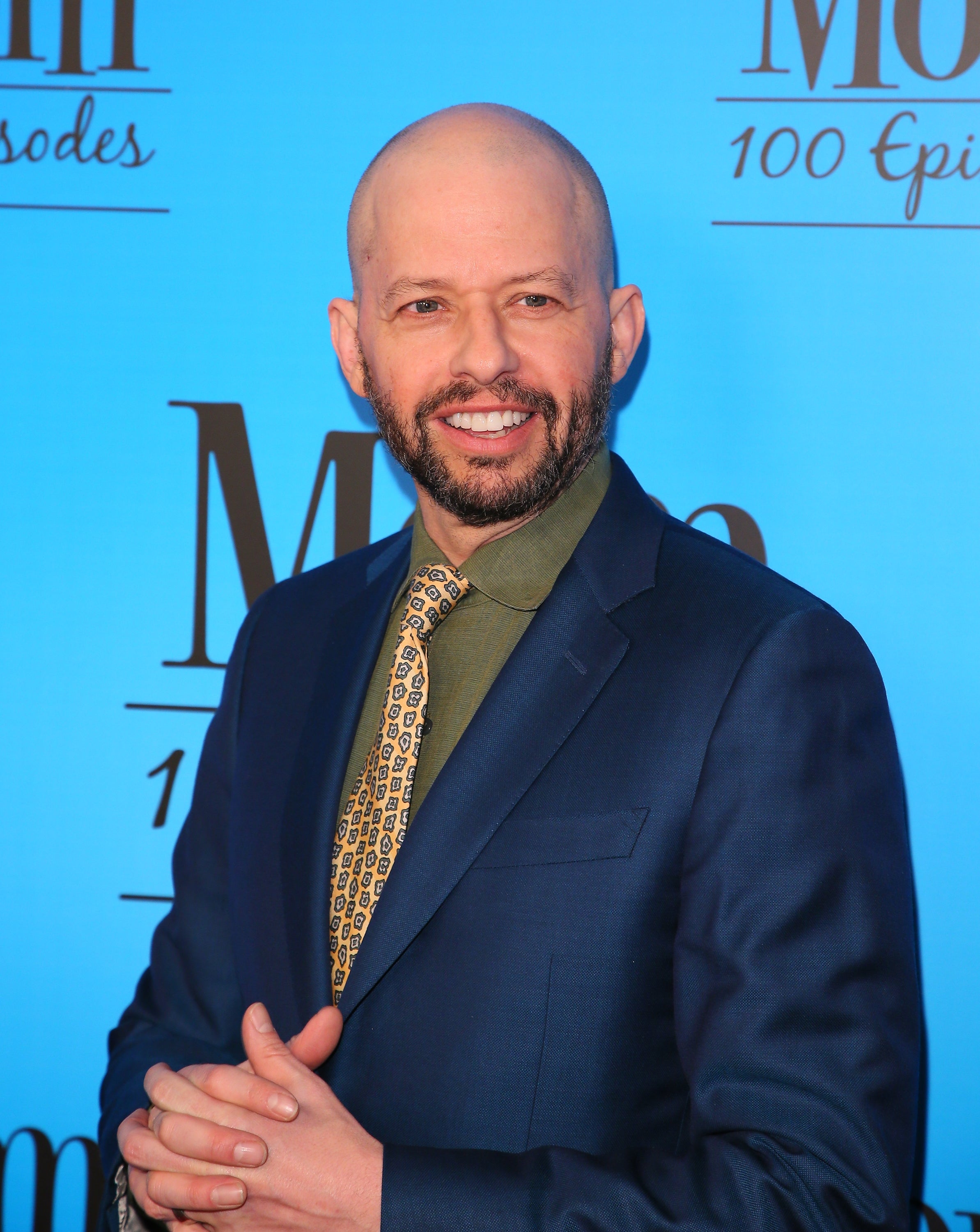 Jon Cryer hair loss