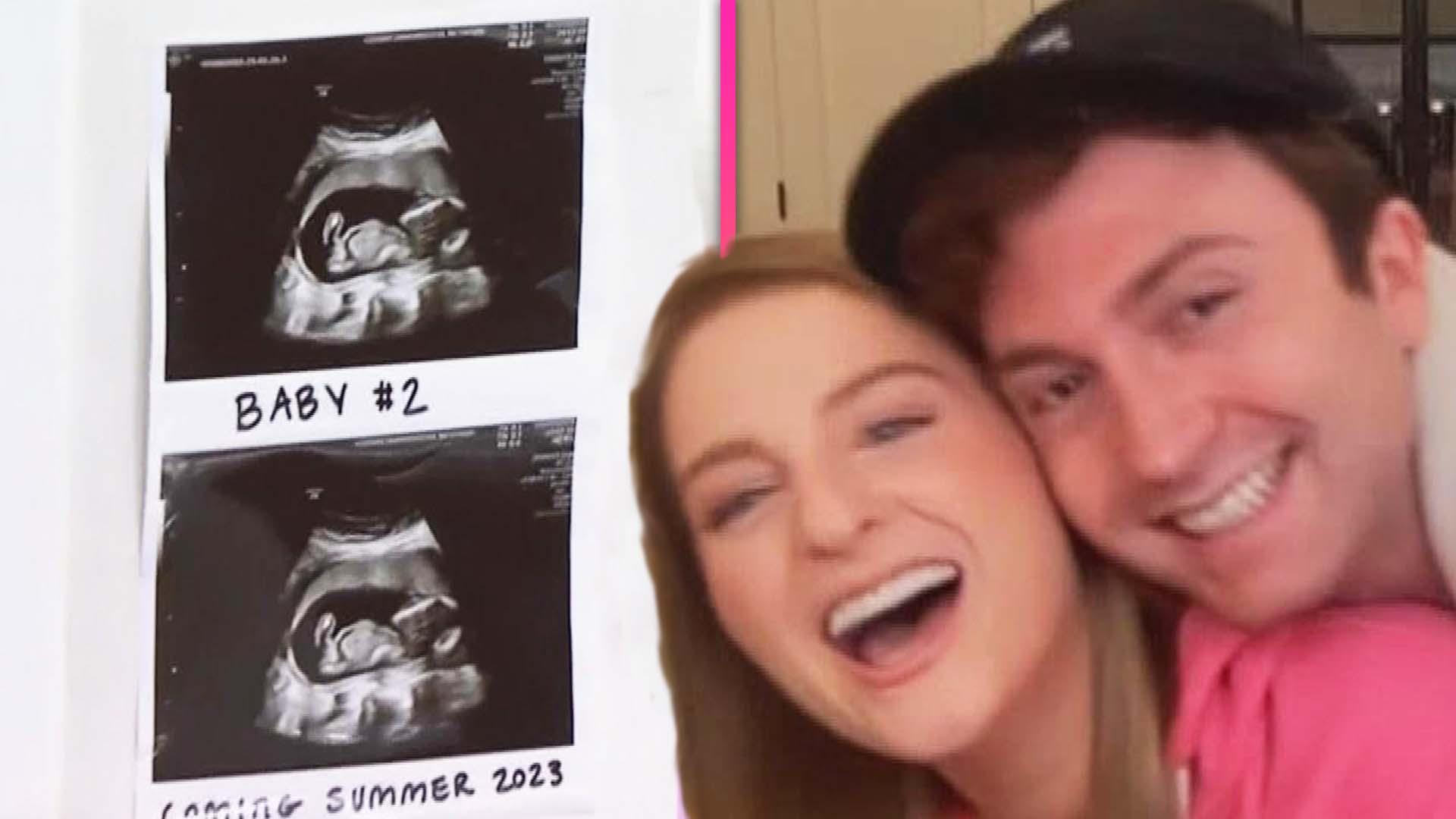 Meghan Trainor announces her second pregnancy - after opening up