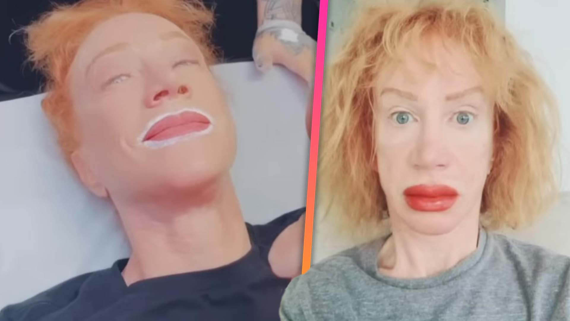 Kathy Griffin Reveals Clownish Pout After Getting Her Lips Tattooed