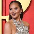 Chrissy Teigen Shows Off Her Boob Lift Scars in Sheer Dress 