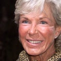 Kim Johnson, 'Survivor: Africa' Runner-Up, Dead at 79