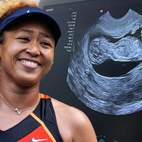 Naomi Osaka Expecting First Child With Rapper Cordae