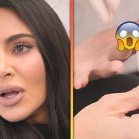 Kim Kardashian Shares Gruesome Finger-Slicing Accident 'More Painful Than Childbirth'