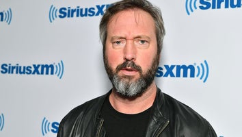 Tom Green Shares Photos of His Severely Burned Feet After Campfire: 'The Good News Is I Have Healed Up'