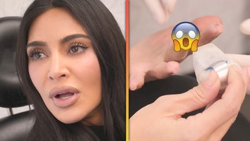 Kim Kardashian Shares Gruesome Finger-Slicing Accident 'More Painful Than Childbirth'