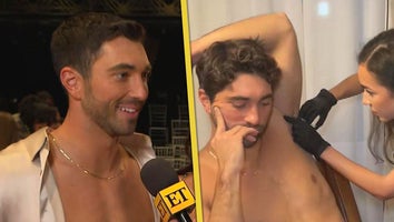 Why Joey Graziadei Got Botox For His Armpits and Why He Wants It Again