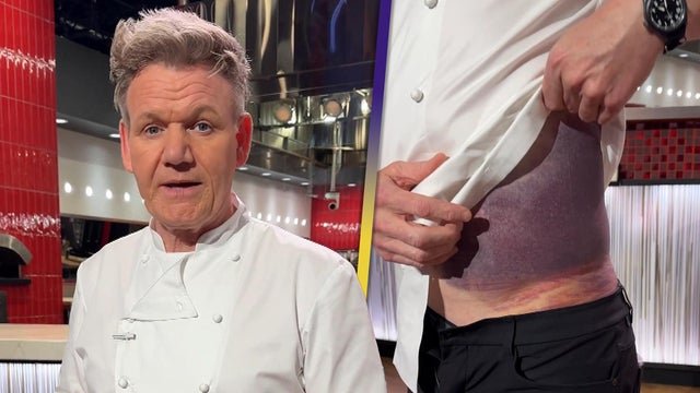 Gordon Ramsay 'Lucky to Be Standing Here' After Bike Crash Leaves Him Badly Bruised