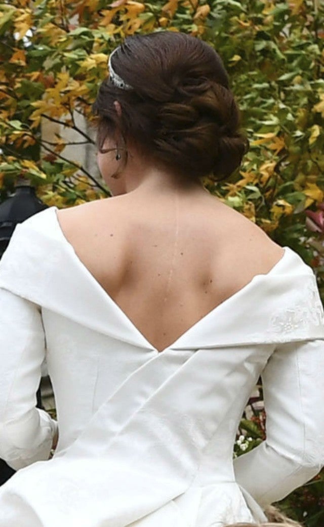 Princess Eugenie Shows Off Her Back Surgery Scars In Royal Wedding Gown 