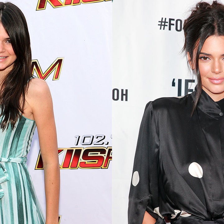 Kendall Jenner Looks Back at Her 'Ugly' Preteen Years