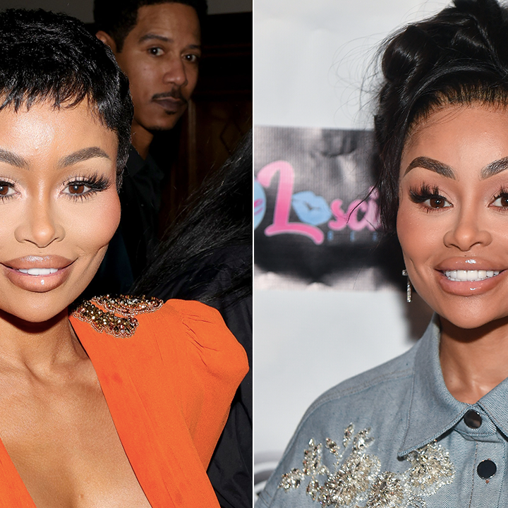 Blac Chyna Dissolves More Facial Fillers on Camera, Explains Why She ...