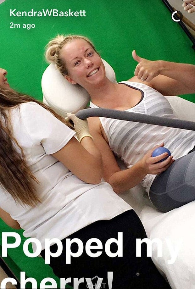 Kendra Wilkinson Snapchats Her First Botox Procedure: 'I'm Finally