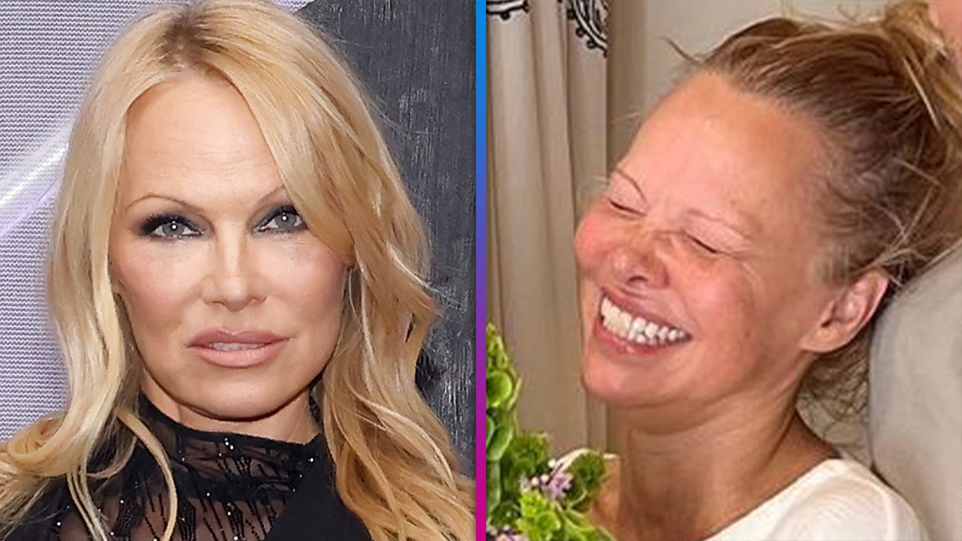 Pamela Anderson Before And After