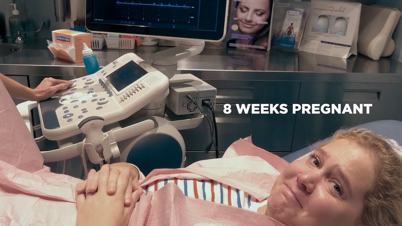 Expecting Amy Sneak Peek Reveals An Emotional Pregnancy Moment Exclusive Entertainment Tonight