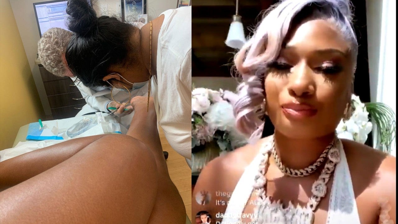 Megan Thee Stallion Reveals Graphic Photos of Her Injuries After Shooting Incident picture photo