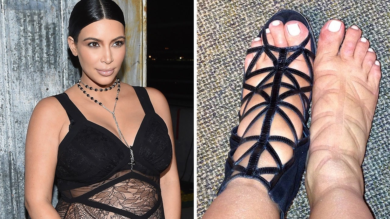 Kim Kardashian's Swollen Pregnancy Feet Return - Poor Kim! 