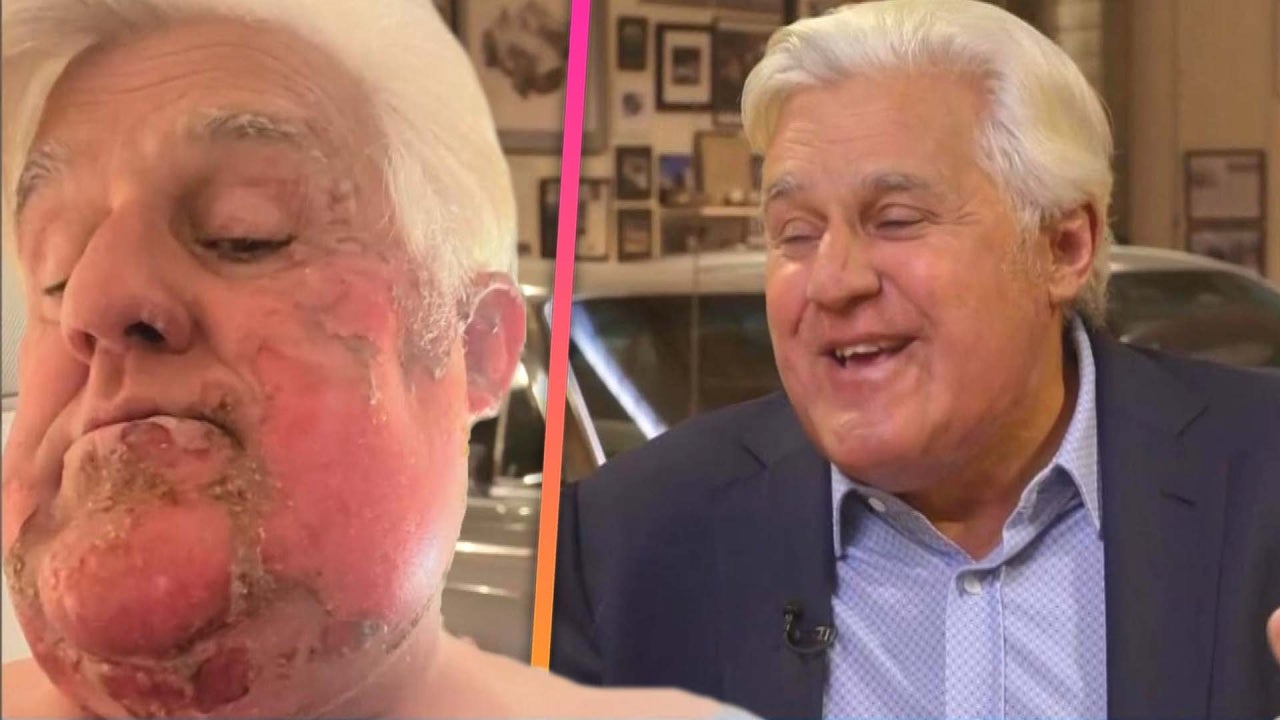 Jay Leno Recounts His Face Catching On Fire In First TV Interview   ETD DN Leno 20221214 