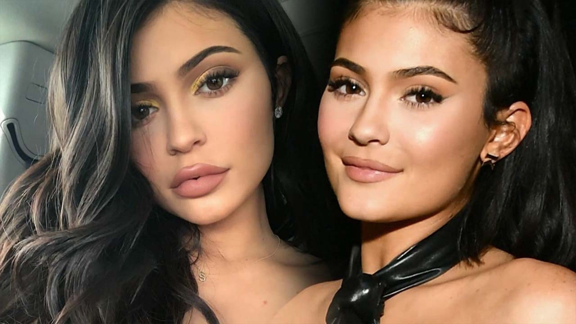 Why Kylie Jenner Decided To Remove Her Lip Fillers Exclusive