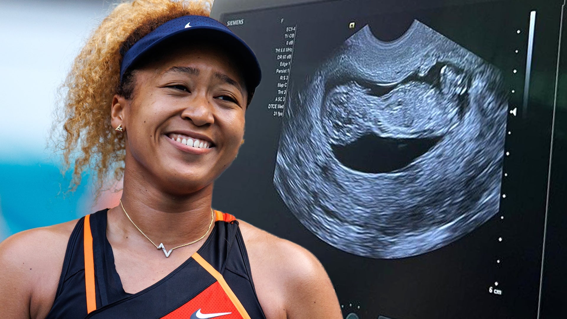 Naomi Osaka Shares First Photo of Newborn Daughter -- and the Baby's Outfit  Is a Grand Slam