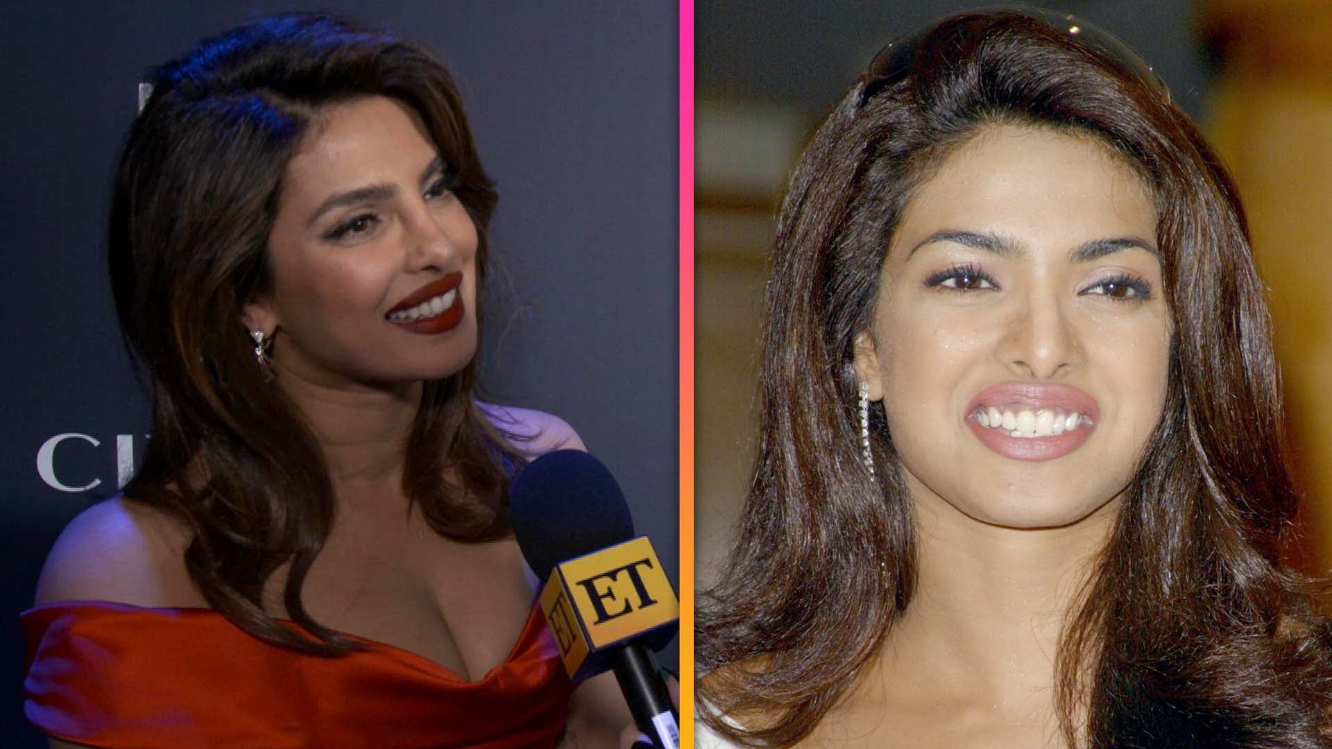 Priyanka Chopra Opens Up About ‘deep Depression After Botched Nose Surgery 2771