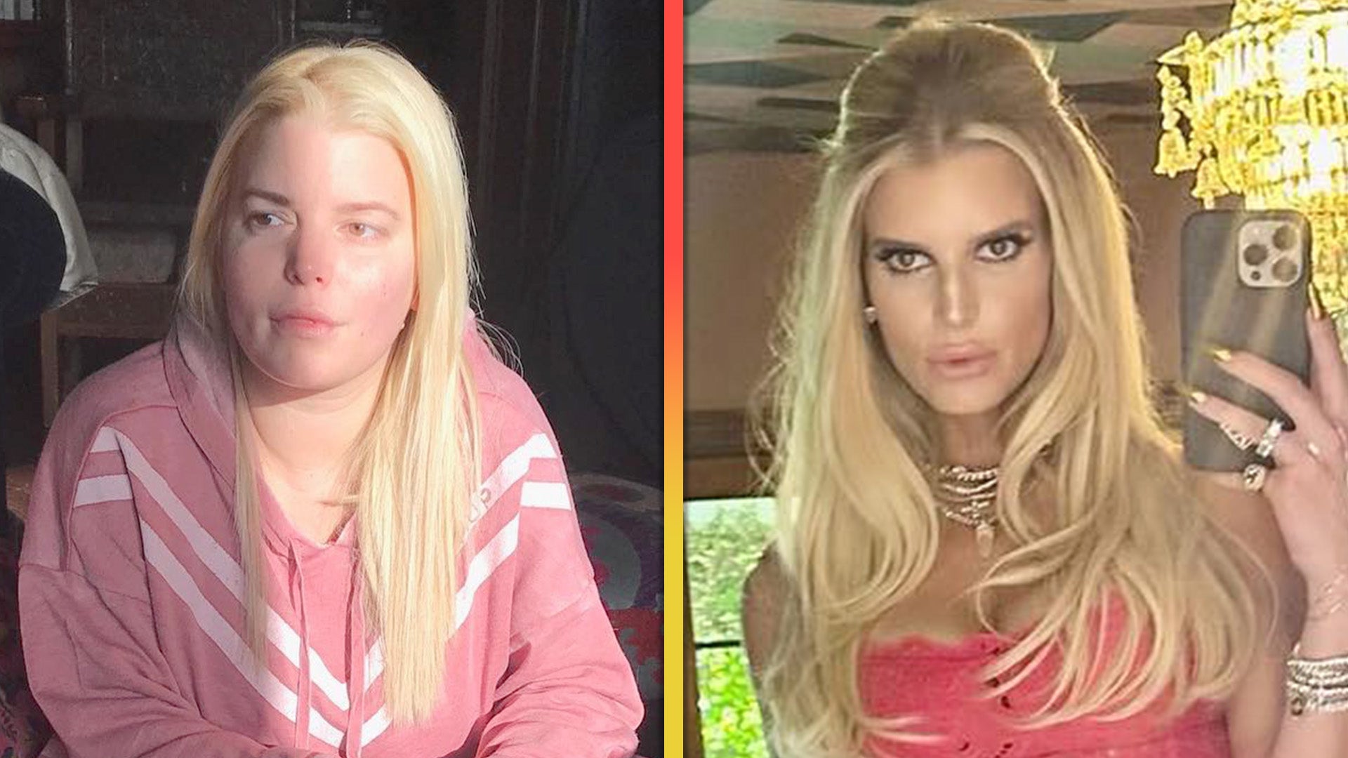 Did Jessica Simpson Get Plastic Surgery? Transformation Photos