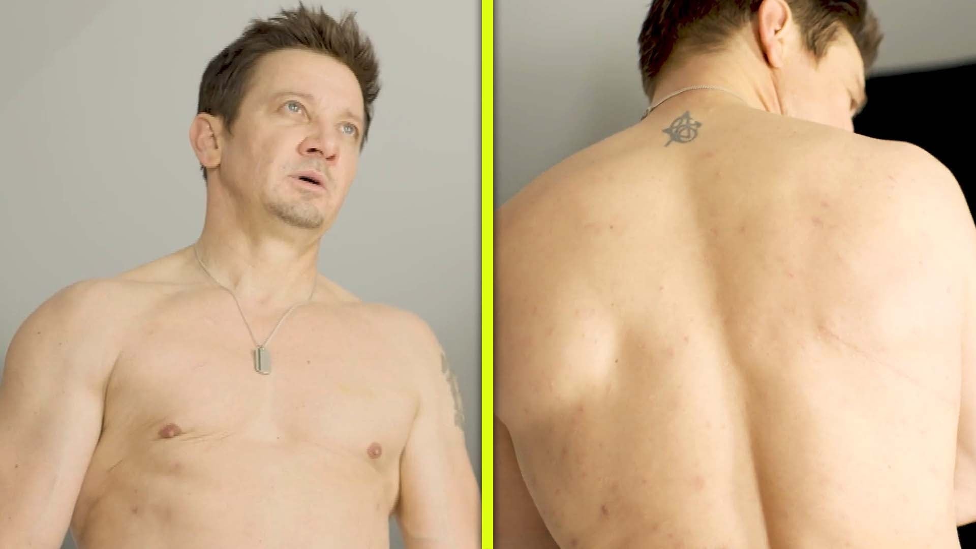 Jeremy Renner Goes Shirtless, Shows Off Snowplow Accident Scars